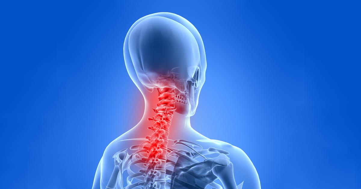 Redondo Beach neck pain and headache treatment