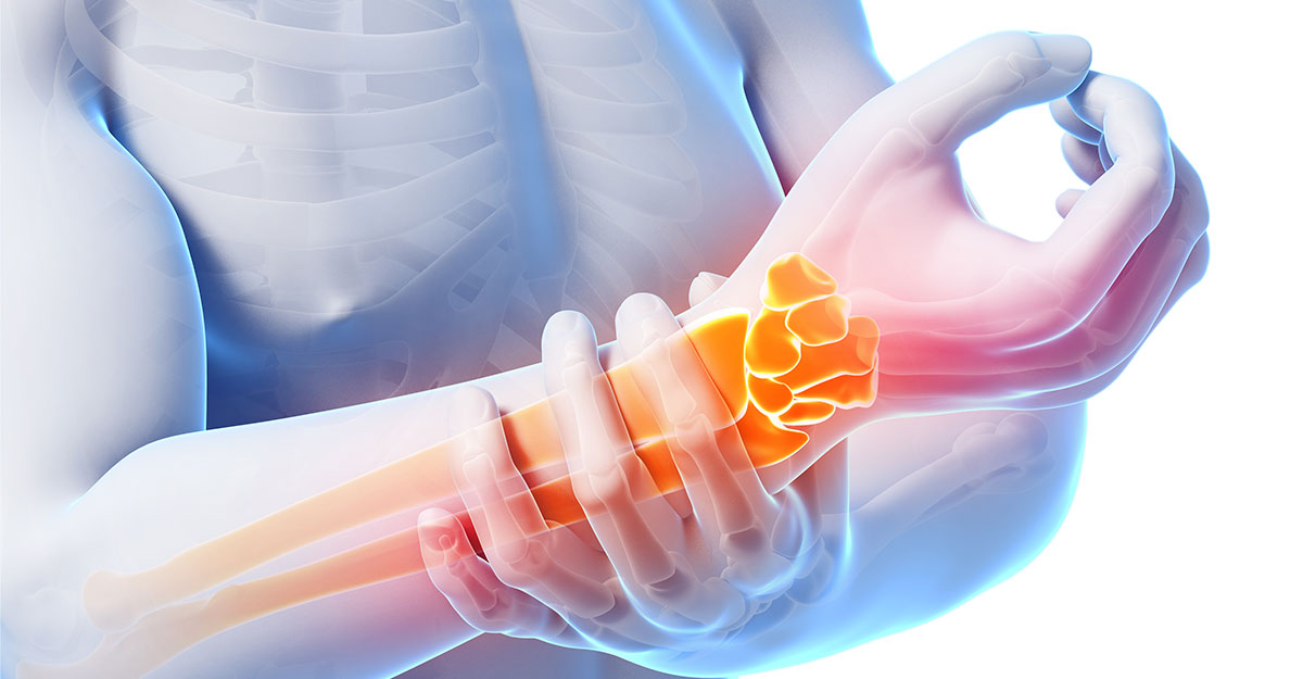 Redondo Beach natural carpal tunnel treatment