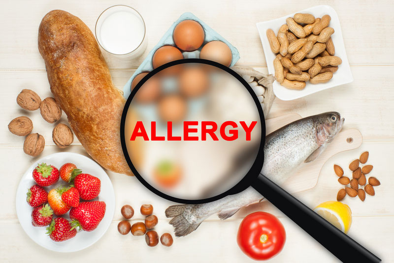 Redondo Beach, CA 90277 food allergies and sensitivity treatment